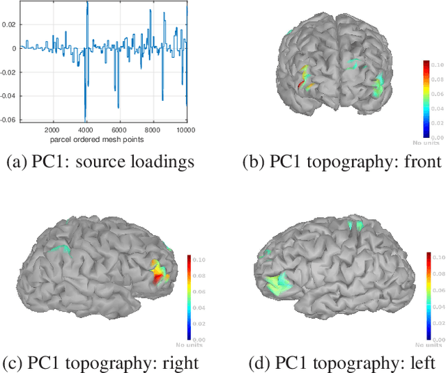 Figure 3 for Space-Time Extension of the MEM Approach for Electromagnetic Neuroimaging