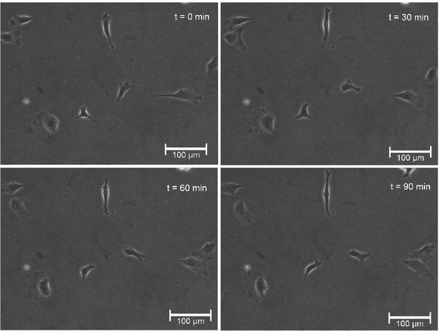 Figure 3 for A Framework for Automated Cell Tracking in Phase Contrast Microscopic Videos based on Normal Velocities