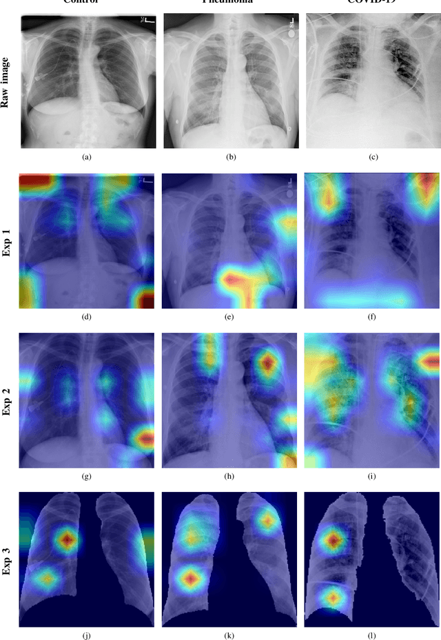 Figure 1 for Artificial Intelligence applied to chest X-Ray images for the automatic detection of COVID-19. A thoughtful evaluation approach