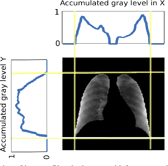 Figure 2 for Artificial Intelligence applied to chest X-Ray images for the automatic detection of COVID-19. A thoughtful evaluation approach