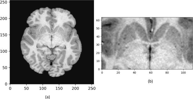 Figure 2 for Automated Human Claustrum Segmentation using Deep Learning Technologies