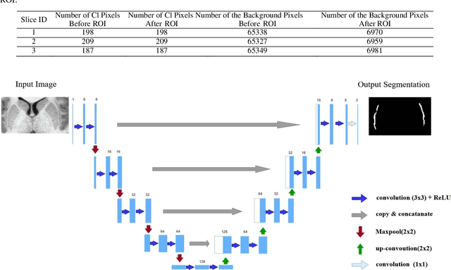 Figure 4 for Automated Human Claustrum Segmentation using Deep Learning Technologies