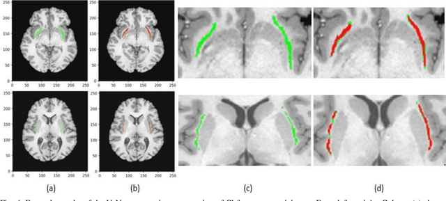 Figure 3 for Automated Human Claustrum Segmentation using Deep Learning Technologies