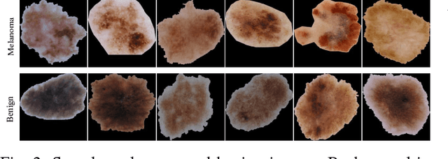 Figure 2 for Unsupervised and semi-supervised learning with Categorical Generative Adversarial Networks assisted by Wasserstein distance for dermoscopy image Classification