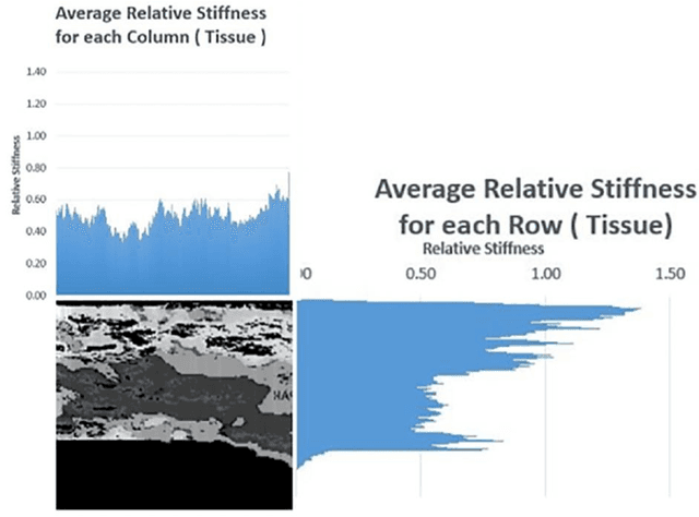 Figure 3 for A quantitative comparison of plantar soft tissue strainability distribution and homogeneity between ulcerated and non-ulcerated patients using strain elastography