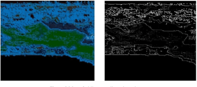 Figure 4 for A quantitative comparison of plantar soft tissue strainability distribution and homogeneity between ulcerated and non-ulcerated patients using strain elastography