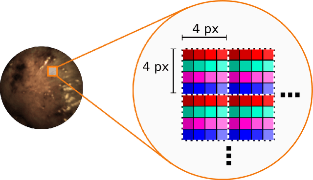 Figure 2 for Video-rate multispectral imaging in laparoscopic surgery: First-in-human application