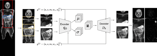 Figure 1 for 3D Reasoning for Unsupervised Anomaly Detection in Pediatric WbMRI