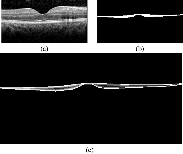 Figure 2 for FourierNet: Shape-Preserving Network for Henle's Fiber Layer Segmentation in Optical Coherence Tomography Images