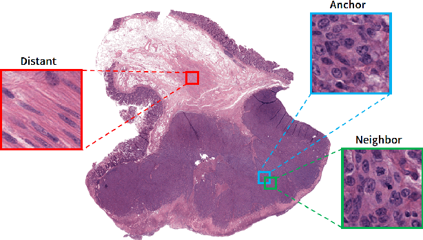Figure 2 for Supervision and Source Domain Impact on Representation Learning: A Histopathology Case Study