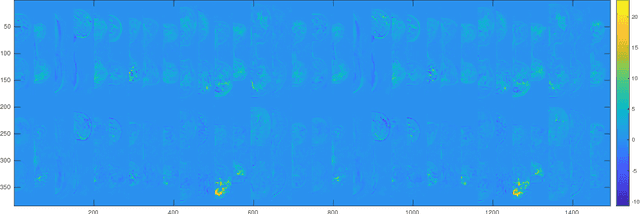Figure 4 for Automated detection and segmentation of non-mass enhancing breast tumors with dynamic contrast-enhanced magnetic resonance imaging