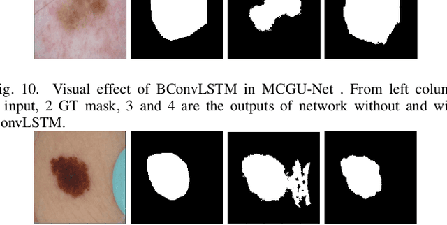 Figure 2 for Multi-level Context Gating of Embedded Collective Knowledge for Medical Image Segmentation