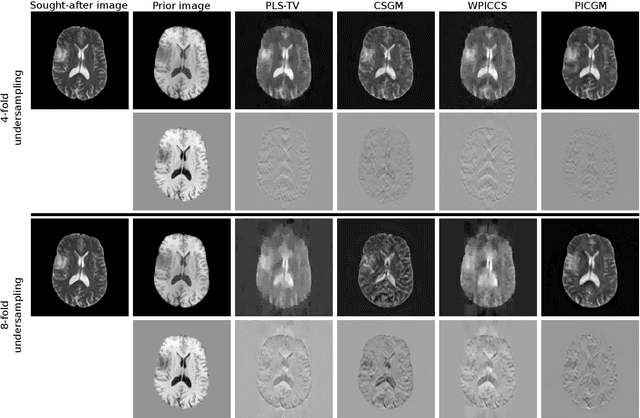 Figure 1 for Prior image-based medical image reconstruction using a style-based generative adversarial network