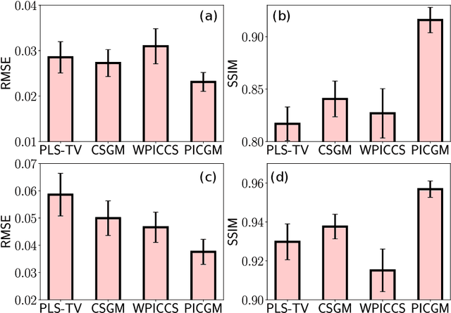 Figure 2 for Prior image-based medical image reconstruction using a style-based generative adversarial network