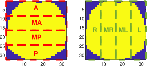 Figure 1 for Classification of Electrical Impedance Tomography Data Using Machine Learning
