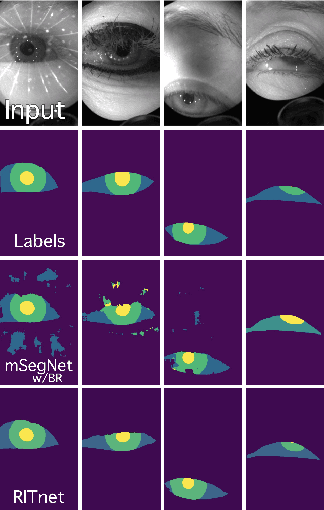 Figure 1 for RITnet: Real-time Semantic Segmentation of the Eye for Gaze Tracking