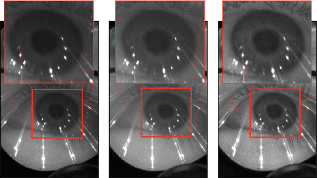 Figure 4 for RITnet: Real-time Semantic Segmentation of the Eye for Gaze Tracking