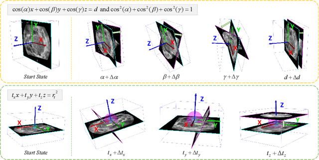 Figure 3 for Agent with Tangent-based Formulation and Anatomical Perception for Standard Plane Localization in 3D Ultrasound