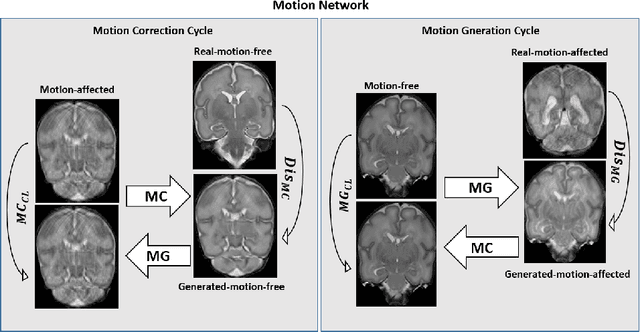 Figure 3 for Generative adversarial network for segmentation of motion affected neonatal brain MRI