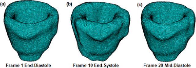 Figure 4 for CNN-based Cardiac Motion Extraction to Generate Deformable Geometric Left Ventricle Myocardial Models from Cine MRI