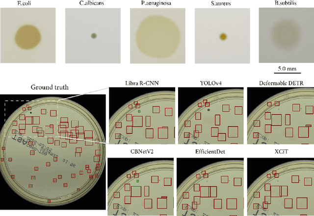 Figure 2 for Deep neural networks approach to microbial colony detection -- a comparative analysis