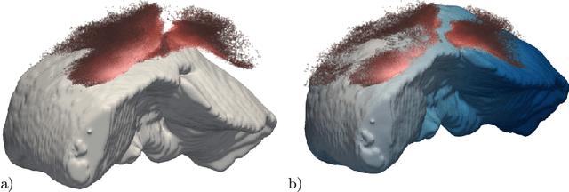 Figure 1 for Non-Rigid Volume to Surface Registration using a Data-Driven Biomechanical Model