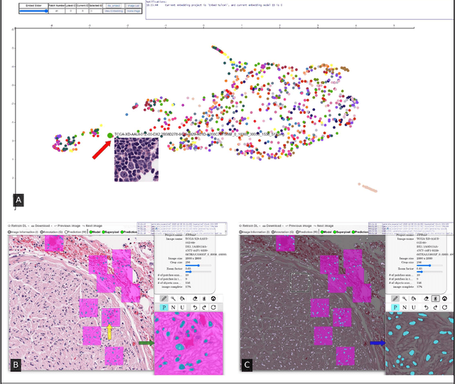 Figure 2 for Quick Annotator: an open-source digital pathology based rapid image annotation tool