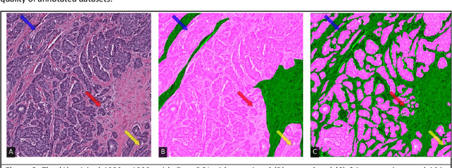 Figure 3 for Quick Annotator: an open-source digital pathology based rapid image annotation tool