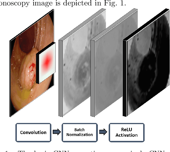 Figure 1 for Towards a Computed-Aided Diagnosis System in Colonoscopy: Automatic Polyp Segmentation Using Convolution Neural Networks
