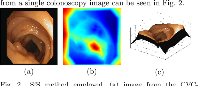 Figure 3 for Towards a Computed-Aided Diagnosis System in Colonoscopy: Automatic Polyp Segmentation Using Convolution Neural Networks