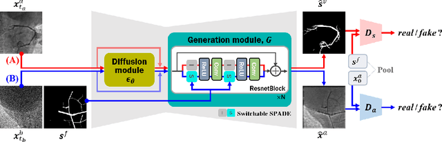 Figure 1 for Diffusion Adversarial Representation Learning for Self-supervised Vessel Segmentation