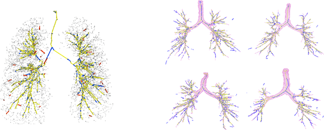 Figure 3 for Mean Field Network based Graph Refinement with application to Airway Tree Extraction