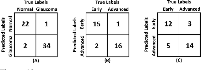 Figure 2 for Clinically Verified Hybrid Deep Learning System for Retinal Ganglion Cells Aware Grading of Glaucomatous Progression