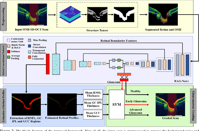 Figure 3 for Clinically Verified Hybrid Deep Learning System for Retinal Ganglion Cells Aware Grading of Glaucomatous Progression