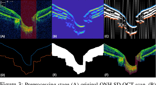 Figure 4 for Clinically Verified Hybrid Deep Learning System for Retinal Ganglion Cells Aware Grading of Glaucomatous Progression
