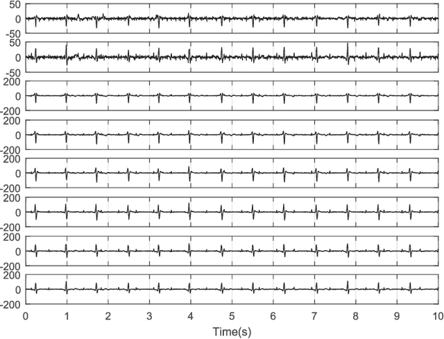 Figure 1 for Temporally Nonstationary Component Analysis; Application to Noninvasive Fetal Electrocardiogram Extraction