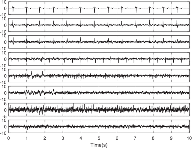 Figure 2 for Temporally Nonstationary Component Analysis; Application to Noninvasive Fetal Electrocardiogram Extraction