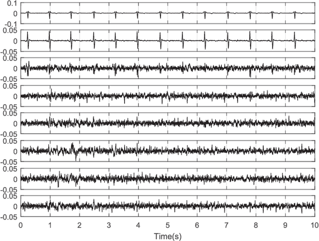 Figure 3 for Temporally Nonstationary Component Analysis; Application to Noninvasive Fetal Electrocardiogram Extraction