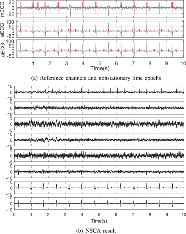 Figure 4 for Temporally Nonstationary Component Analysis; Application to Noninvasive Fetal Electrocardiogram Extraction