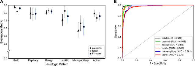 Figure 3 for Pathologist-level classification of histologic patterns on resected lung adenocarcinoma slides with deep neural networks