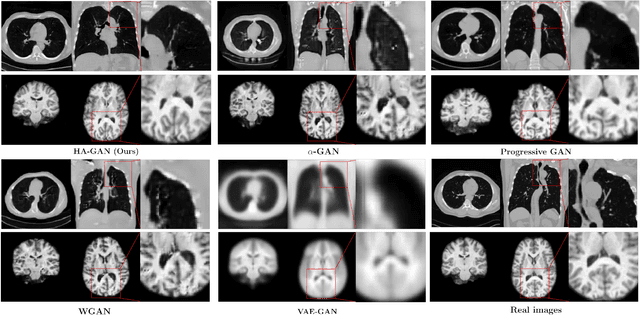 Figure 3 for Hierarchical Amortized Training for Memory-efficient High Resolution 3D GAN