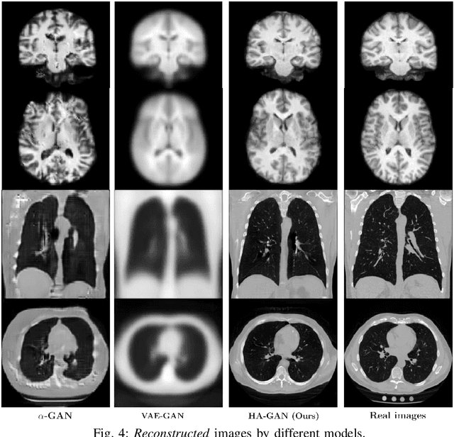 Figure 4 for Hierarchical Amortized Training for Memory-efficient High Resolution 3D GAN