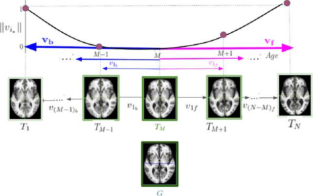 Figure 1 for A Diffeomorphic Aging Model for Adult Human Brain from Cross-Sectional Data