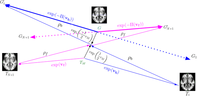 Figure 3 for A Diffeomorphic Aging Model for Adult Human Brain from Cross-Sectional Data