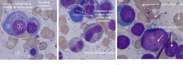 Figure 2 for Multiple Myeloma Cancer Cell Instance Segmentation