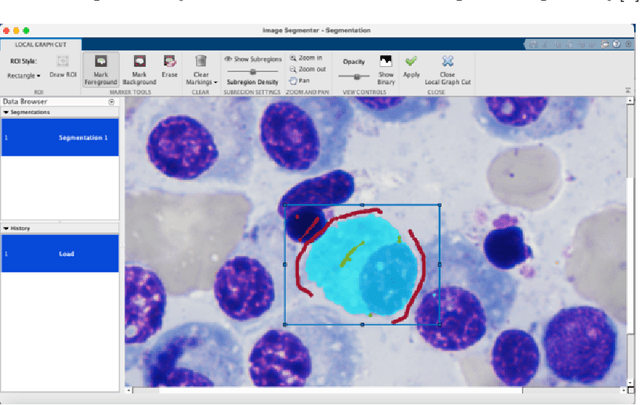Figure 3 for Multiple Myeloma Cancer Cell Instance Segmentation