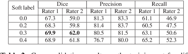 Figure 4 for Soft labeling by Distilling Anatomical knowledge for Improved MS Lesion Segmentation