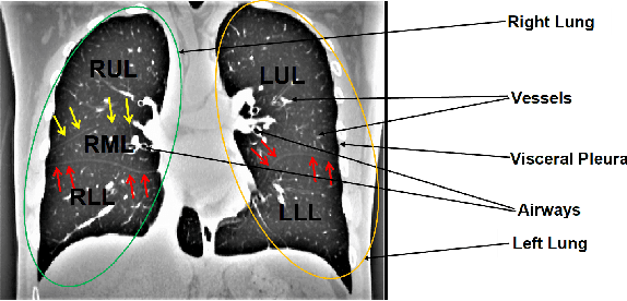 Figure 1 for Automatic Segmentation of Pulmonary Lobes Using a Progressive Dense V-Network