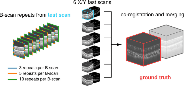 Figure 1 for Maximum a posteriori signal recovery for optical coherence tomography angiography image generation and denoising