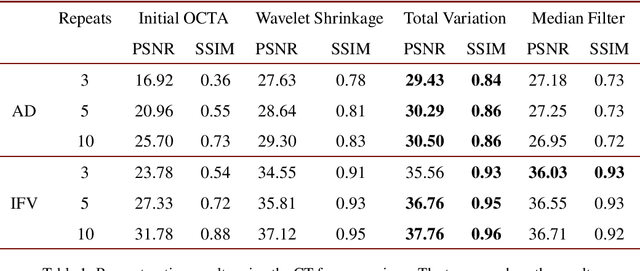 Figure 2 for Maximum a posteriori signal recovery for optical coherence tomography angiography image generation and denoising